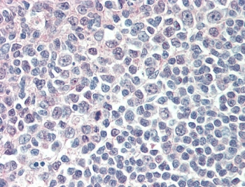 IHC testing of FFPE human tonsil tissue with IRF8 antibody at 5ug/ml. Steamed antigen retrieval with citrate buffer pH 6, AP-staining.