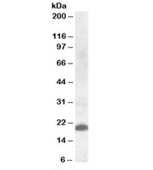 CLEC4C Antibody Human Spleen WB. Western blot analysis of human spleen lysate using CLEC4C Antibody detects a band at approximately 21 kDa, consistent with the predicted molecular weight of CLEC4C / CD303 (BDCA2). The observed signal supports detection of this plasmacytoid dendritic cell receptor in lymphoid tissue, aligning with its role as a surface marker of pDC populations involved in immune regulation.