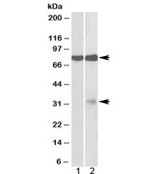 Western blot testing of 1) fetal mouse brain and 2) rat brain lysate with GPM6A antibody at 2ug/ml. Predicted molecular weight: ~32/80kDa (unmodified/glycosylated).