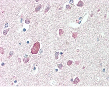 IHC testing of FFPE human brain (cortex) tissue with PTGDS antibody at 5ug/ml. Required HIER: steamed antigen retrieval with pH6 citrate buffer; AP-staining.
