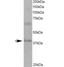Western blot testing of human heart lysate with ABTB1 antibody at 1ug/ml. Predicted molecular weight ~38/54 kDa (isoforms 1/2).