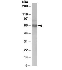 ATR Antibody Human PBMC WB. Western blot analysis of ATR Antibody / ANTXR1 Antibody detected a prominent band at approximately 63 kDa in human PBMC lysate, consistent with the cleaved PA63 form of ANTXR1 (full-length receptor approximately 83 kDa). The membrane was incubated with ATR antibody at 0.3 ug/ml followed by an HRP-conjugated secondary antibody for chemiluminescent detection. This ATR Antibody, also known as an ANTXR1 antibody, is suitable for detecting endogenous Anthrax Toxin Receptor 1 in human immune cell lysates.