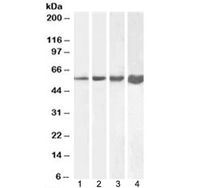 Desmin Antibody Human/Mouse/Rat/Pig WB. Western blot testing of 1) human, 2) mouse, 3) rat and 4) pig skeletal muscle lysate with Desmin antibody at 1ug/ml. Predicted molecular weight ~54 kDa.