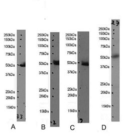 IDO2 Antibody Human Tissue WB. Western blot testing of human A) kidney, B) placenta, C) tonsil and D) liver tissue lysate with IDO2 antibody. Expected molecular weight: ~47 kDa.