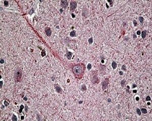 IHC staining of FFPE human brain with Synaptotagmin 1 antibody at 4ug/ml. HIER: steamed with pH6 citrate buffer, AP-staining.