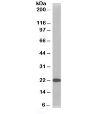 TMS1 / PYCARD Antibody WB. Western blot analysis of HeLa cell lysate using TMS1 / PYCARD Antibody at 1 ug/ml. A distinct immunoreactive band is detected at approximately 22 kDa, consistent with the predicted molecular weight of PYCARD (TMS1/ASC), supporting specific detection of the endogenous inflammasome adaptor protein in human HeLa cells.