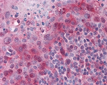 TMS1 / PYCARD Antibody Human Tonsil IHC. Immunohistochemical staining of FFPE human tonsil using TMS1 Antibody / PYCARD at 2.5 ug/ml. PYCARD expression is detected predominantly within the cytoplasm of lymphoid cells, consistent with its role as an inflammasome adaptor protein involved in innate immune signaling, inflammatory cytokine maturation, and pyroptotic cell death. Heat-induced epitope retrieval was performed by steaming sections in pH 6 citrate buffer prior to AP-based immunostaining.