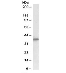 Delta-Sarcoglycan Antibody Human Heart WB. Western blot analysis of human heart lysate using Delta-Sarcoglycan Antibody / SGCD Antibody. Protein was detected with the primary antibody at 0.1 ug/ml. A distinct band is observed at approximately 35 kDa, consistent with the predicted molecular weight of delta-sarcoglycan. The strong signal in heart tissue is consistent with the abundant expression of SGCD in cardiac muscle, where it functions as a core component of the sarcoglycan complex within the dystrophin-associated glycoprotein complex. This Delta-Sarcoglycan Antibody, also called SGCD Antibody, is suitable for studies of sarcoglycan biology, muscle membrane stability, muscular dystrophy, and cardiac and skeletal muscle physiology.