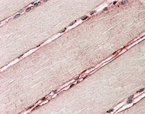 Delta-Sarcoglycan Antibody Human Skeletal Muscle IHC. Immunohistochemical analysis of FFPE human skeletal muscle using Delta-Sarcoglycan Antibody / SGCD Antibody. Heat-induced epitope retrieval was performed by steaming tissue sections in pH6 citrate buffer, followed by alkaline phosphatase-based detection. The primary antibody was applied at 3.8 ug/ml. Distinct sarcolemmal staining outlines individual skeletal muscle fibers, consistent with the expected membrane localization of delta-sarcoglycan within the sarcoglycan complex. This Delta-Sarcoglycan Antibody, also called SGCD Antibody, is suitable for studies of sarcoglycan biology, muscle membrane stability, dystrophin-associated protein complexes, and skeletal and cardiac muscle physiology.