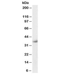 Western blot testing of human heart lysate with Delta-Sarcoglycan Antibody Biotin Conjugate at 0.3ug/ml. Predicted molecular weight: ~35kDa.