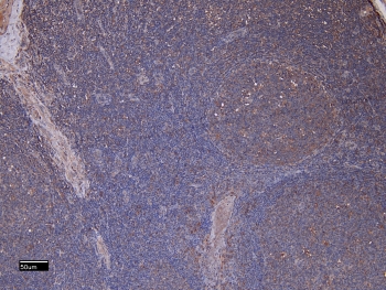 IHC staining of FFPE human tonsil tissue with CD11b antibody at 8ug/ml. Required HIER: steamed antigen retrieval with pH6 citrate buffer; HRP-staining.