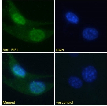 IF/ICC staining of fixed and permeabilized human U-2 OS cells with RIF1 antibody (green) at 10ug/ml and DAPI nuclear stain (blue).