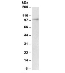Western blot testing of mouse kidney lysate with Malt1 antibody at 2ug/ml. Predicted molecular weight: ~92kDa.