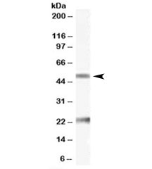 Western blot testing of human ovay lysate with Fibulin 5 antibody at 0.1ug/ml. The expected ~50kDa band and the additional ~23kDa band are both blocked by the immunizing peptide.