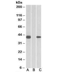 Western blot of HEK293 lysate overexpressing human FANCF-MYC probed with FANCF antibody [1ug/ml] in Lane A and anti-MYC [1/1000] in lane C. Mock-transfected HEK293 probed with FANCF antibody [1ug/ml] in Lane B. Predicted molecular weight: ~42kDa.