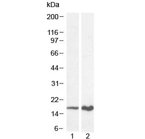 Western blot testing of 1) mouse and 2) rat liver lysate with p16INK4a antibody at 0.3ug/ml. Predicted molecular weight ~16 kDa.