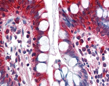 IHC testing of FFPE human small intestine tissue with ACSL5 antibody at 5ug/ml. Required HIER: steamed antigen retrieval with pH6 citrate buffer; AP-staining.