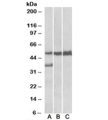 Western blot of human liver lysate (lane 1), mouse liver lysate (lane 2) and rat liver lysate (lane 3) with LSP1 antibody at 0.05ug/ml. Predicted molecular weight: ~37kDa but is routinely observed at ~52kDa (PMID: 15684321).