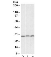 Western blot of NIH3T3 (A), mouse spleen (B), rat spleen (C) lysates with PSMA4 antibody at 0.3ug/ml. Predicted molecular weight: 29kDa.