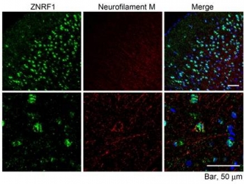 IHC staining of FFPE mouse cerebral cortex with Znrf1 antibody at 10ug/ml. HIER: microwaved with pH6 citrate buffer, streptavidin-Alexa Fluor 488-staining after biotinylated secondary.