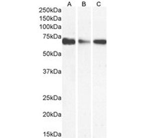Western blot testing of human A) K562, B) Caco-2 and 3) HepG2 cell lysate with IFNGR1 antibody at 1ug/ml. Predicted molecular weight: ~54 kDa (unmodified), 80-100 kDa (glycosylated).