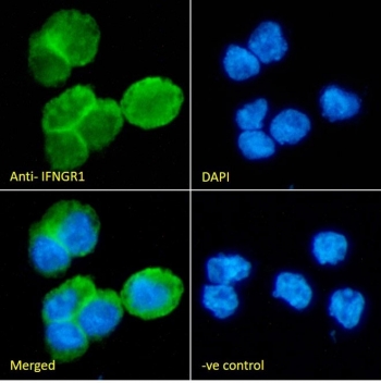IF/ICC staining of fixed and permeabilized human ThP1 cells with IFNGR1 antibody (green) at 10ug/ml and DAPI nuclear stain (blue).