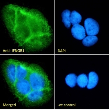 IF/ICC staining of fixed and permeabilized human Caco-2 cells with IFNGR1 antibody (green) at 10ug/ml and DAPI nuclear stain (blue).