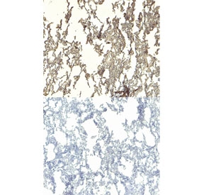 IHC staining of FFPE human lung tissue (left) and negative control without primary (right) with IFNGR1 antibody at 4ug/ml. Required HIER: steamed antigen retrieval with pH6 citrate buffer; HRP-staining.