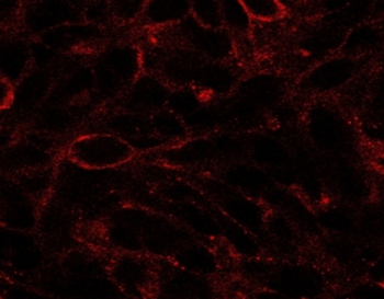 Immunofluorescence testing of U87 cells with DISP1 antibody at 2.5ug/ml