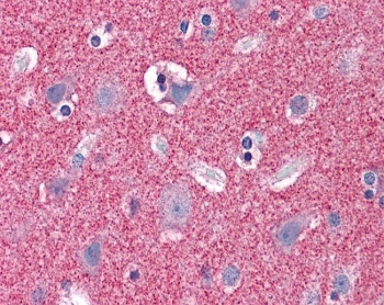 IHC testing of FFPE human cortex (brain) tissue with Septin 3 antibody at 3.75ug/ml. Required HIER: steamed antigen retrieval with pH6 citrate buffer; AP-staining.
