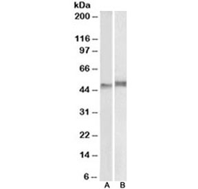 Western blot testing of mouse thymus (A) and pig spleen (B) lysate with p47phox antibody at 1ug/ml. Expected/observed molecular weight ~47 kDa.