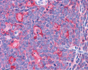 IHC testing of FFPE human tonsil tissue with TPD52L2 antibody at 3.75ug/ml. Required HIER: steamed antigen retrieval with pH6 citrate buffer; AP-staining.