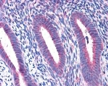IHC testing of FFPE human uterus tissue with RPL22 antibody at 3.75ug/ml. HIER: steamed with pH6 citrate buffer, AP-staining.