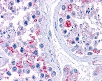IHC testing of FFPE human testis tissue with RPL22 antibody at 3.75ug/ml. HIER: steamed with pH6 citrate buffer, AP-staining.