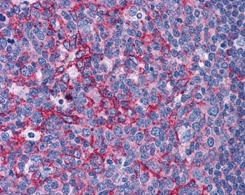 IHC testing of FFPE human tonsil tissue with Flotillin 2 antibody at 3.75ug/ml. Required HIER: steamed antigen retrieval with pH6 citrate buffer; AP-staining.