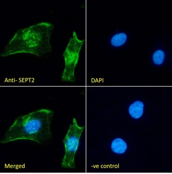 Immunofluorescent staining of fixed and permeabilized human HeLa cells with SEPT2 antibody (green) at 10ug/ml and DAPI nuclear stain (blue).