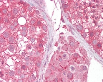 IHC testing of FFPE human testis tissue with MCT2 antibody at 2.5ug/ml. HIER: steamed antigen retrieval with pH6 citrate buffer; AP-staining.