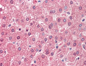IHC testing of FFPE human liver tissue with ALDH6A1 antibody at 5ug/ml. Required HIER: steamed antigen retrieval with pH6 citrate buffer; AP-staining.