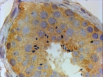 PIWIL1 Antibody Human Testis IHC. Immunohistochemistry staining of FFPE human testis using PIWIL1 Antibody / Testicular Germ Cell Marker Antibody demonstrates strong cytoplasmic HRP-DAB brown staining within seminiferous tubule germ cell populations. The staining pattern is consistent with expression of PIWIL1 (HIWI), a member of the PIWI family of Argonaute proteins that regulates piRNA-mediated gene silencing, transposon suppression, genome stability, and germ cell development. PIWIL1 is highly associated with spermatogenesis and germline maintenance, making it a valuable marker for studies of reproductive biology, fertility, and germ cell differentiation. HIER was performed by steaming tissue sections in pH 6 citrate buffer prior to immunostaining. Primary antibody was applied at 4 ug/ml and detected using an HRP-DAB staining system.