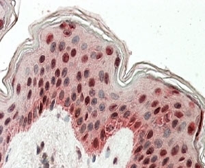 IHC staining of FFPE human skin with TIAR antibody at 4ug/ml. HIER: steamed with pH6 citrate buffer, AP-staining.