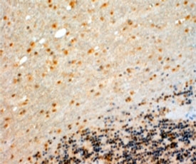 IHC testing of FFPE human cerebellum with CYP26B1 antibody at 4ug/ml. HIER: steamed with pH9 Tris/EDTA buffer, HRP-staining.