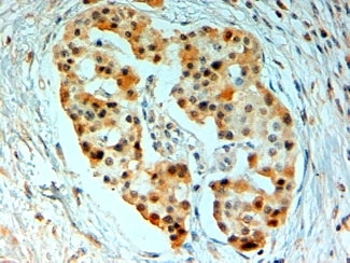 IHC staining of FFPE human pancreas with SIRT4 antibody at 2ug/ml. HIER: steamed with pH6 citrate buffer, AP-staining.