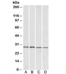 Western blot of A) mouse brain,  B) rat brain, C) mouse liver and D) rat liver lysates with SIAH1 antibody at 1ug/ml. Predicted molecular weight: ~31kDa.