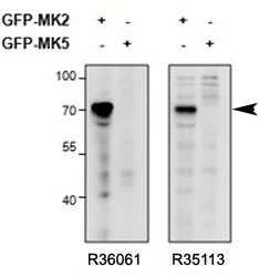 MAPKAPK2 Antibody Overexpression Specificity WB. Western blot analysis of HEK293 cell lysates overexpressing mouse MK2-GFP or MK5-GFP using goat polyclonal MAPKAPK2 antibodies Cat. # R36061 (left) and Cat. # R35113 (right). Both antibodies detect a prominent band at approximately 72 kDa in MK2-GFP-expressing lysates, consistent with the predicted molecular weight of MAP kinase-activated protein kinase 2 fused to GFP. Minimal cross-reactivity with the related MK5-GFP kinase construct supports selective recognition of MAPKAPK2 / MK2.