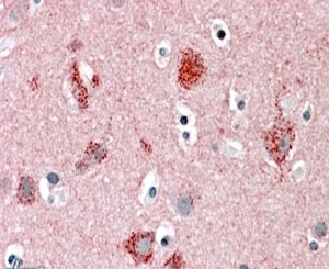 STXBP1 Antibody Human Cortex IHC. Immunohistochemical staining of FFPE human cortex with STXBP1 / MUNC18-1 antibody at 5 ug/ml. Heat-induced epitope retrieval (HIER) was performed by steaming tissue sections in pH 6 citrate buffer prior to alkaline phosphatase (AP) staining. Strong STXBP1 immunoreactivity is observed predominantly within the cytoplasm of cortical neurons, with little staining of the surrounding neuropil, consistent with the expected neuronal expression pattern of MUNC18-1. Cell nuclei are counterstained with hematoxylin (blue).