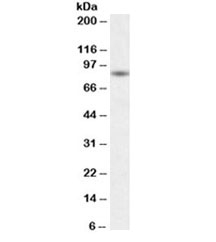 Western blot testing of human skeletal muscle lysate with BAG3 antibody at 0.1ug/ml. Predicted molecular weight ~62 kDa but can be observed at 75~80 kDa.