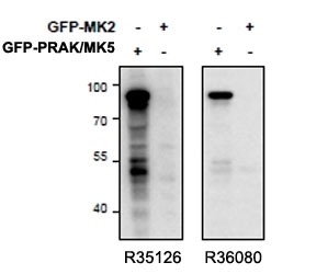 PRAK Antibody Stress Kinase Specificity WB. Western blot analysis of HEK293 cell lysates overexpressing mouse MK5 / PRAK or mouse MK2 using goat polyclonal PRAK antibody Cat. # R36080 (0.5 ug/ml). A strong band is detected near 90 kDa in MK5/PRAK-expressing cells, consistent with the expected molecular weight of the PRAK-GFP fusion protein. No detectable cross-reactivity is observed with MK2, supporting selective detection of the p38-regulated stress kinase MAPKAPK5 / PRAK.