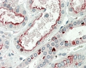 PRAK Antibody Kidney IHC. Immunohistochemistry analysis of FFPE human kidney tissue stained with goat polyclonal PRAK antibody at 5 ug/ml. Following HIER in pH 6 citrate buffer, distinct AP-red cytoplasmic and apical staining is observed in renal tubular epithelial cells, consistent with expression of MAPKAPK5 / PRAK, a p38-regulated stress kinase involved in cellular adaptation and stress-responsive signaling pathways.