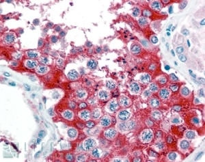 IHC staining of FFPE human testis with G6PD antibody at 2.5ug/ml. HIER: steamed with pH6 citrate buffer, AP-staining.