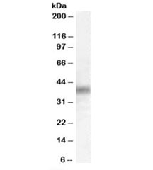 DUSP1 Antibody HeLa WB. Western blot analysis of DUSP1 expression was performed using anti-DUSP1 antibody in human HeLa cell lysate. DUSP1, also known as Dual Specificity Phosphatase 1 or MKP1 (MAP Kinase Phosphatase 1), is a stress-inducible phosphatase that negatively regulates MAPK signaling through dephosphorylation of ERK, JNK, and p38 kinases. A specific immunoreactive band is detected at approximately 39 kDa, corresponding to the predicted molecular weight of DUSP1. Expression in HeLa cells is consistent with the established role of DUSP1 as a feedback regulator of cellular stress responses, inflammatory signaling, and growth factor-mediated pathways. The blot was performed using DUSP1 antibody at 0.3 ug/ml. These results support the utility of DUSP1 Antibody for studies of MAPK regulation, signal transduction, cellular adaptation, and stress-responsive signaling networks.
